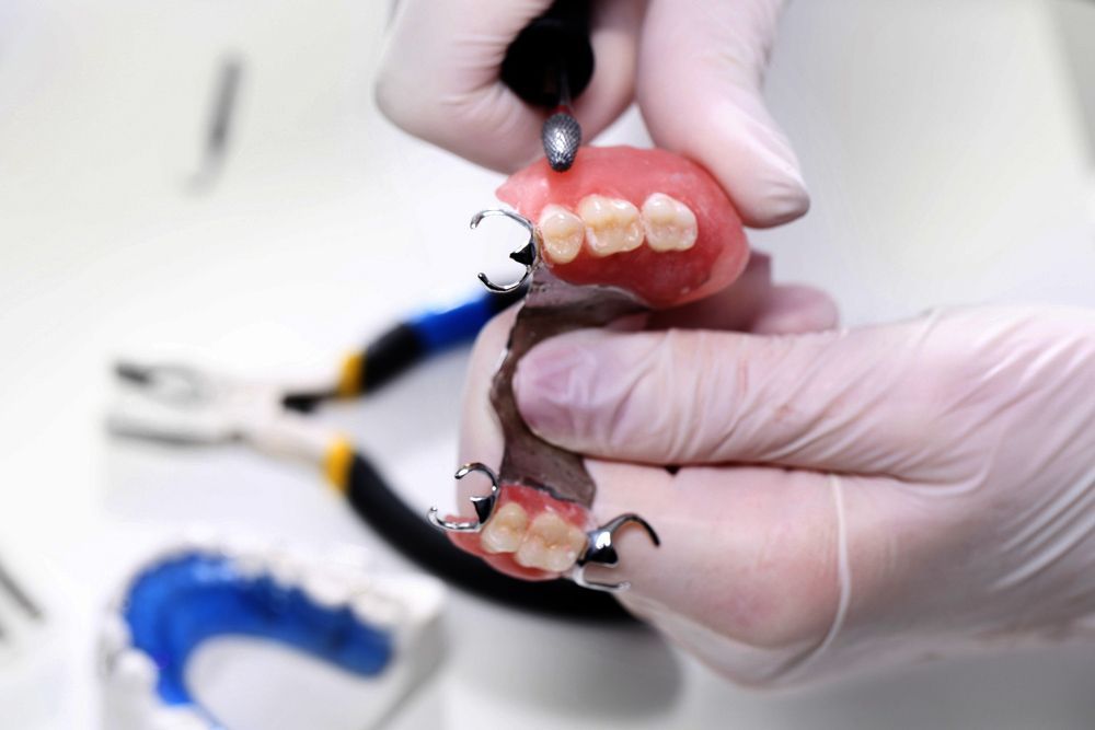 A Professional Denture Repair