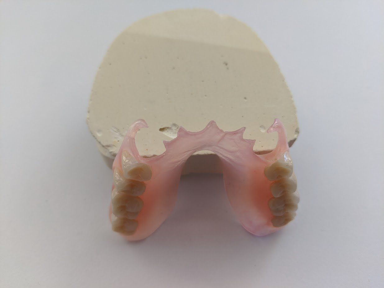 Close Up Of Dentist With Tooth Color Samples — Local Denture Clinic in Sunshine Coast, QLD