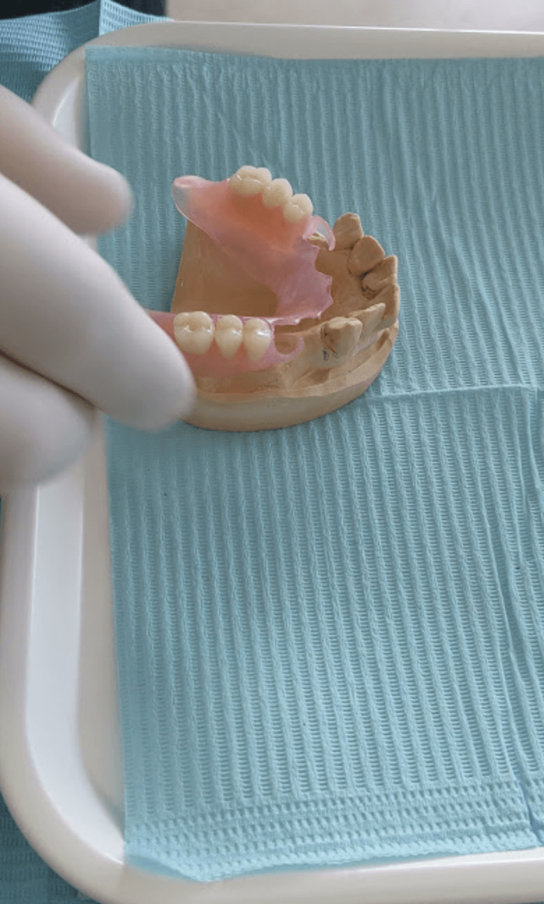 Dental Rehabilitation With Removable Partial Denture — Local Denture Clinic in Woombye, QLD