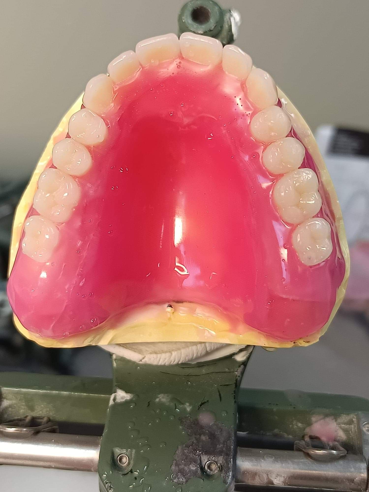 Best Denture Picture With The Focus On Teeth — Local Denture Clinic in Sunshine Coast, QLD