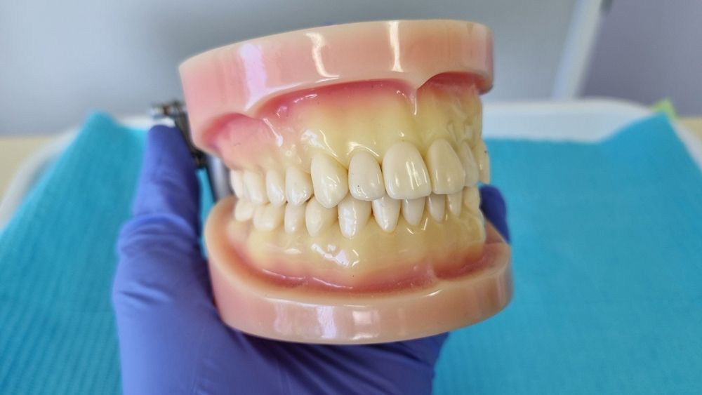 Dentist Holding a Molding of Teeth