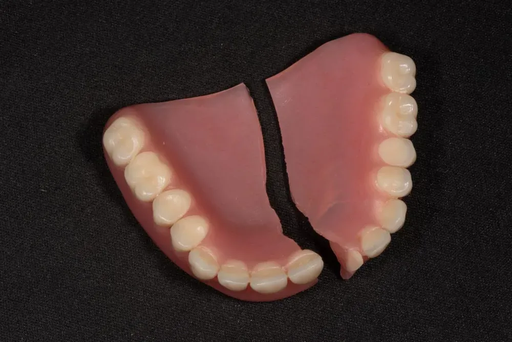 Broken Denture — Local Denture Clinic in Sunshine Coast, QLD