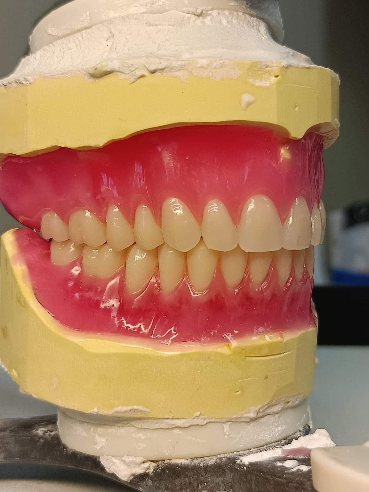 Working On New Dentures On The Sunshine Coast