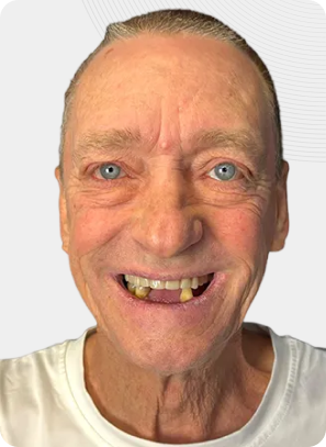 Smiling person with fair skin, blue eyes, and missing front teeth. Wearing a white shirt.