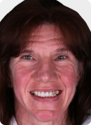 Woman smiling, brown hair, facing forward with wrinkles and pinkish skin tone.