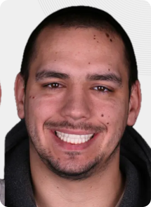 Man smiling, showing white teeth. He has short hair and is wearing a dark top.