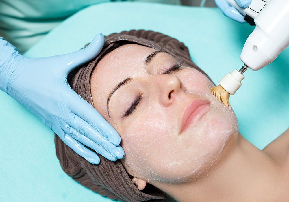 Mechanical Peeling — Schererville, IN — Jill's Skin Care