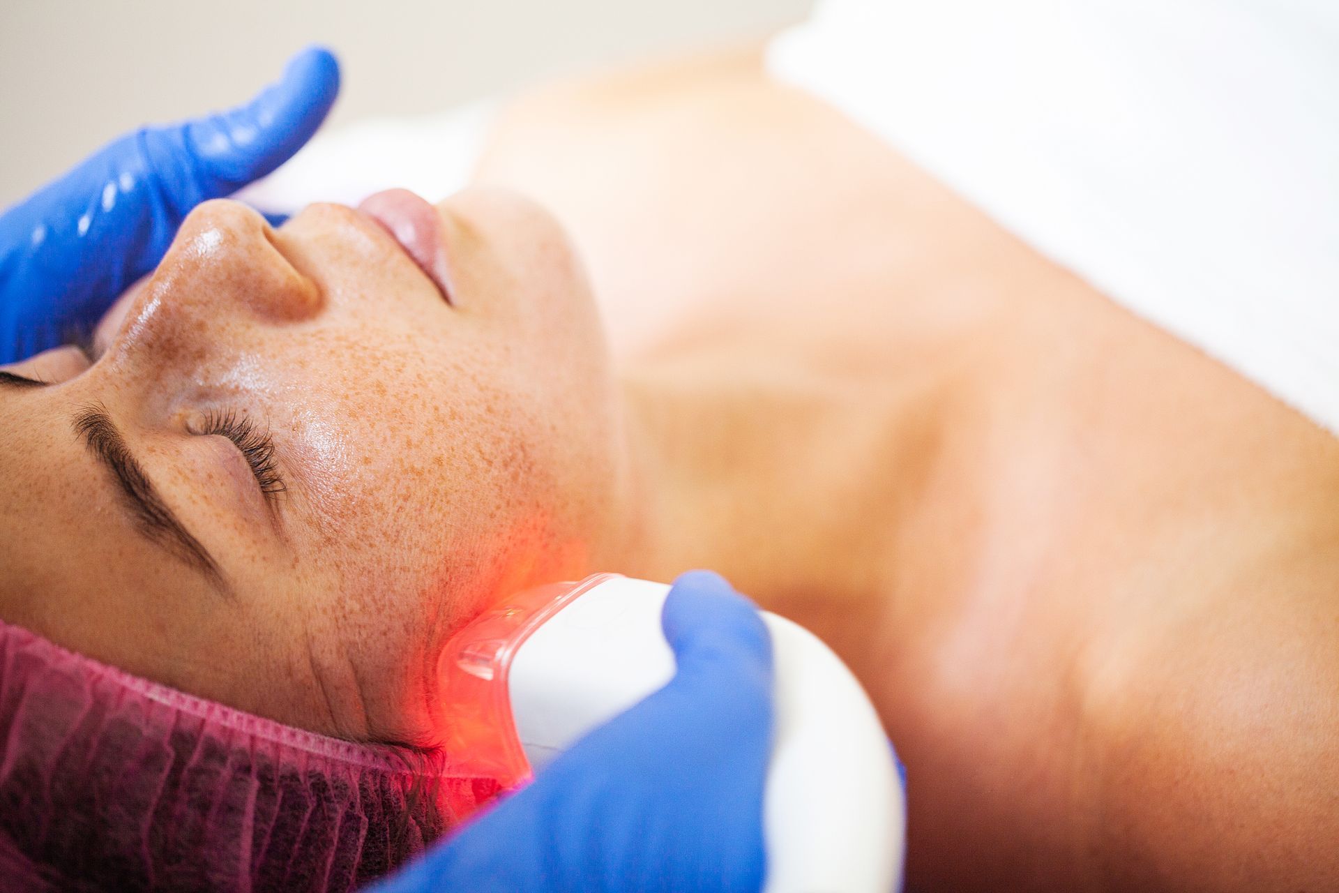 A woman is getting a laser treatment on her face.