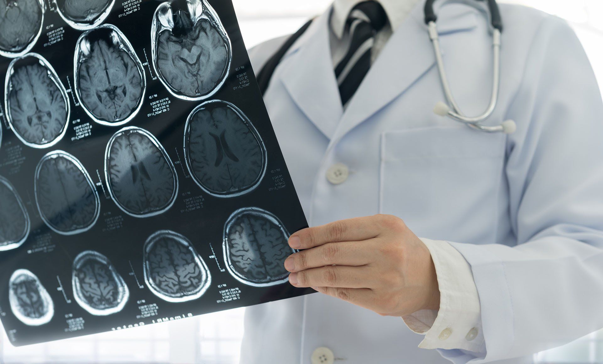 Brain MRI — Nashville, TN — Nashville Healthcare Center