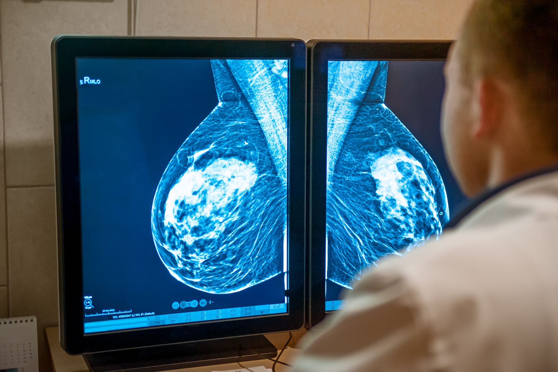 A doctor is examining a mammogram snapshot.