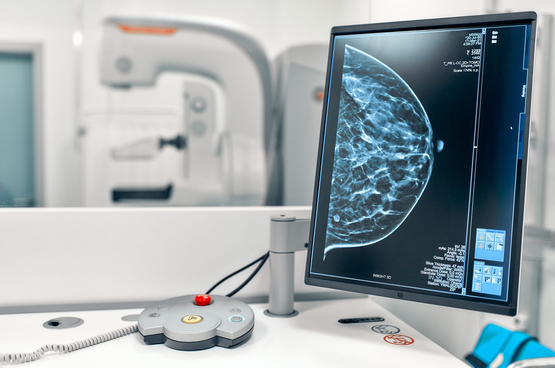 Mammogram snapshot of breasts of a female patient on the monitor with undergoing test.