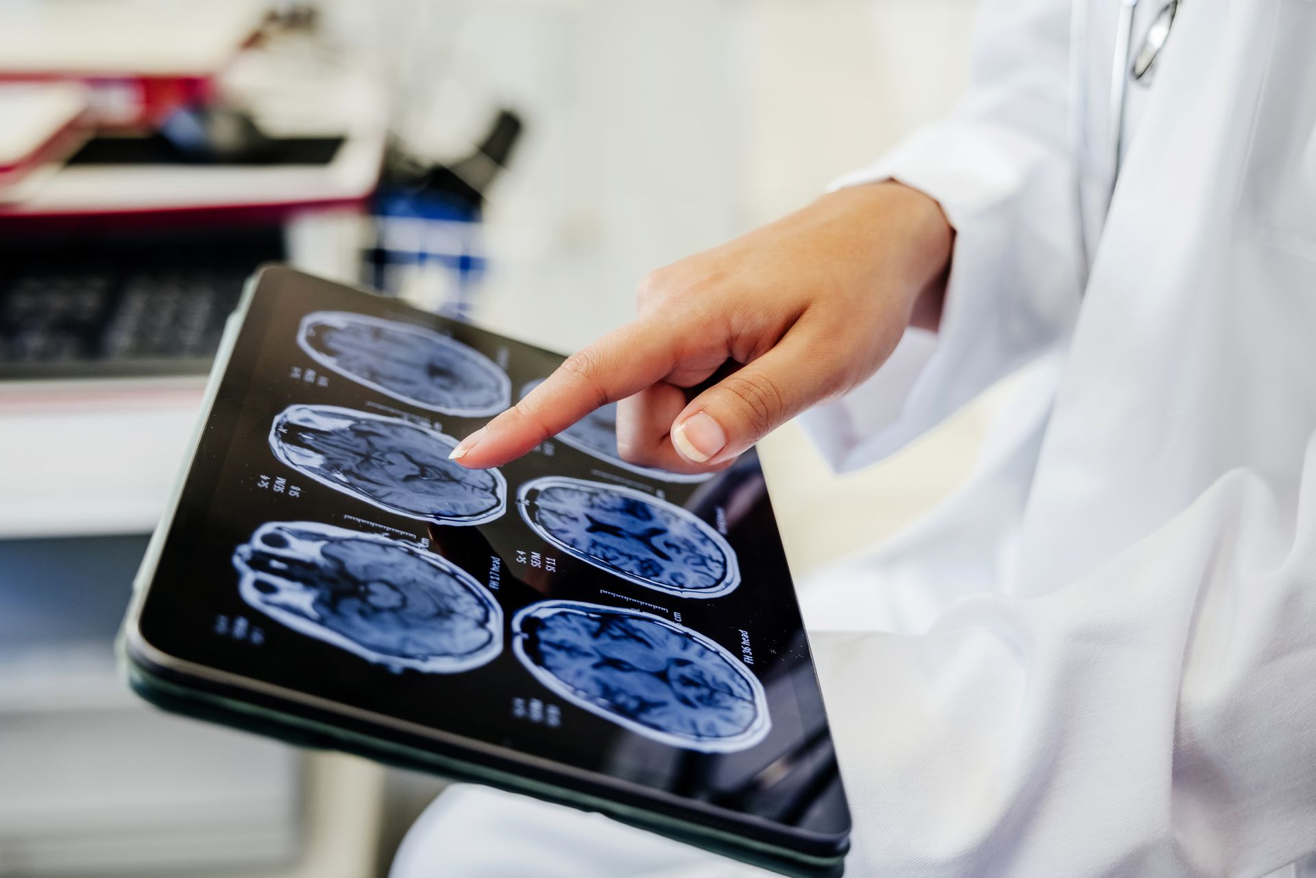 Close view of a doctor’s hand pointing at a brain scan image tablet.