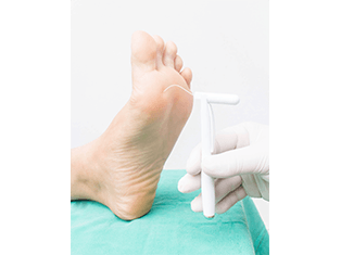 Book for an appointment for Diabetes Assessment feet diabetes assessed