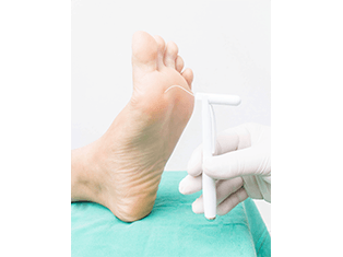 feet diabetes assessed