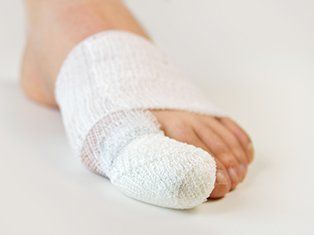 Book for an appointment for Nail Surgery toenails surgery