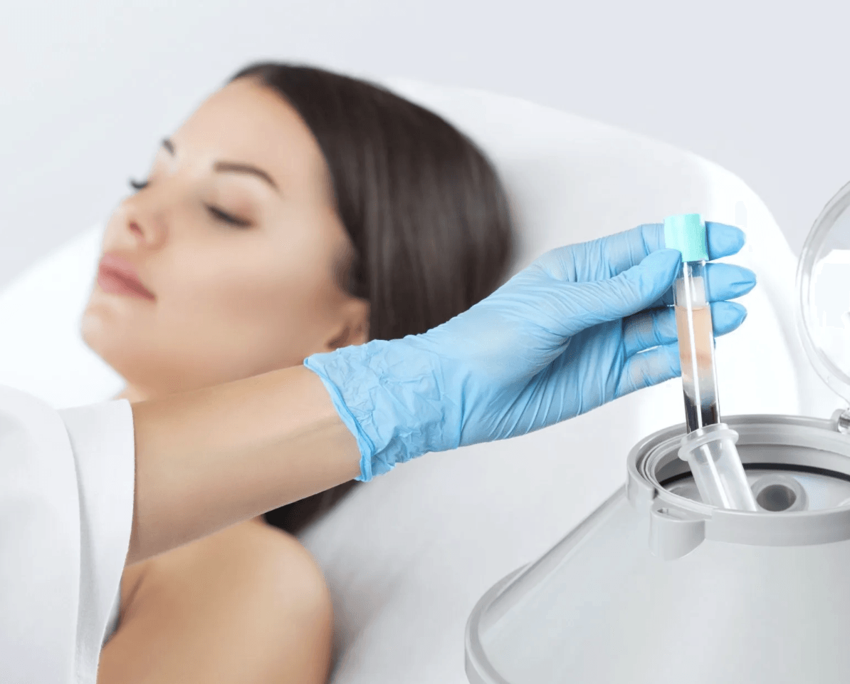 Gloved hand holding PRP vial next to relaxed female patient during microneedling with PRP treatment