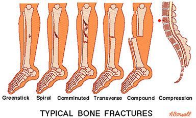 Scar Tissue/Adhesion Treatment