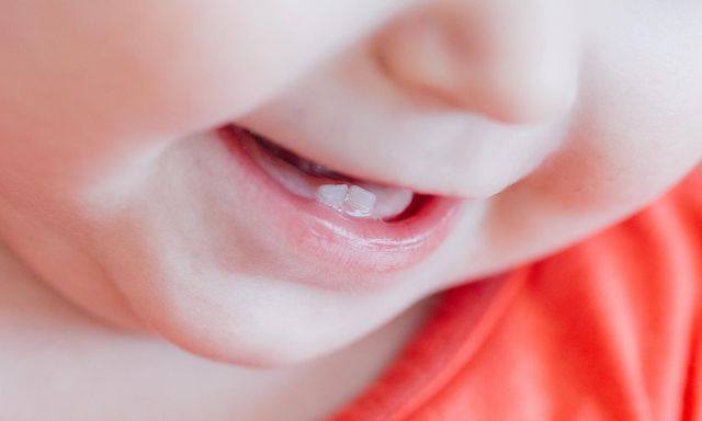 All You Need to Know About Baby Teeth