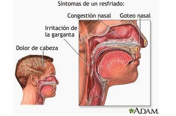 DR. GREGORIO DÍAZ SÁNCHEZ - Alergias de la nariz