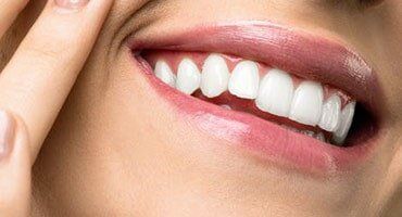 White Teeth — Digital Dentistry in Sarina, QLD
