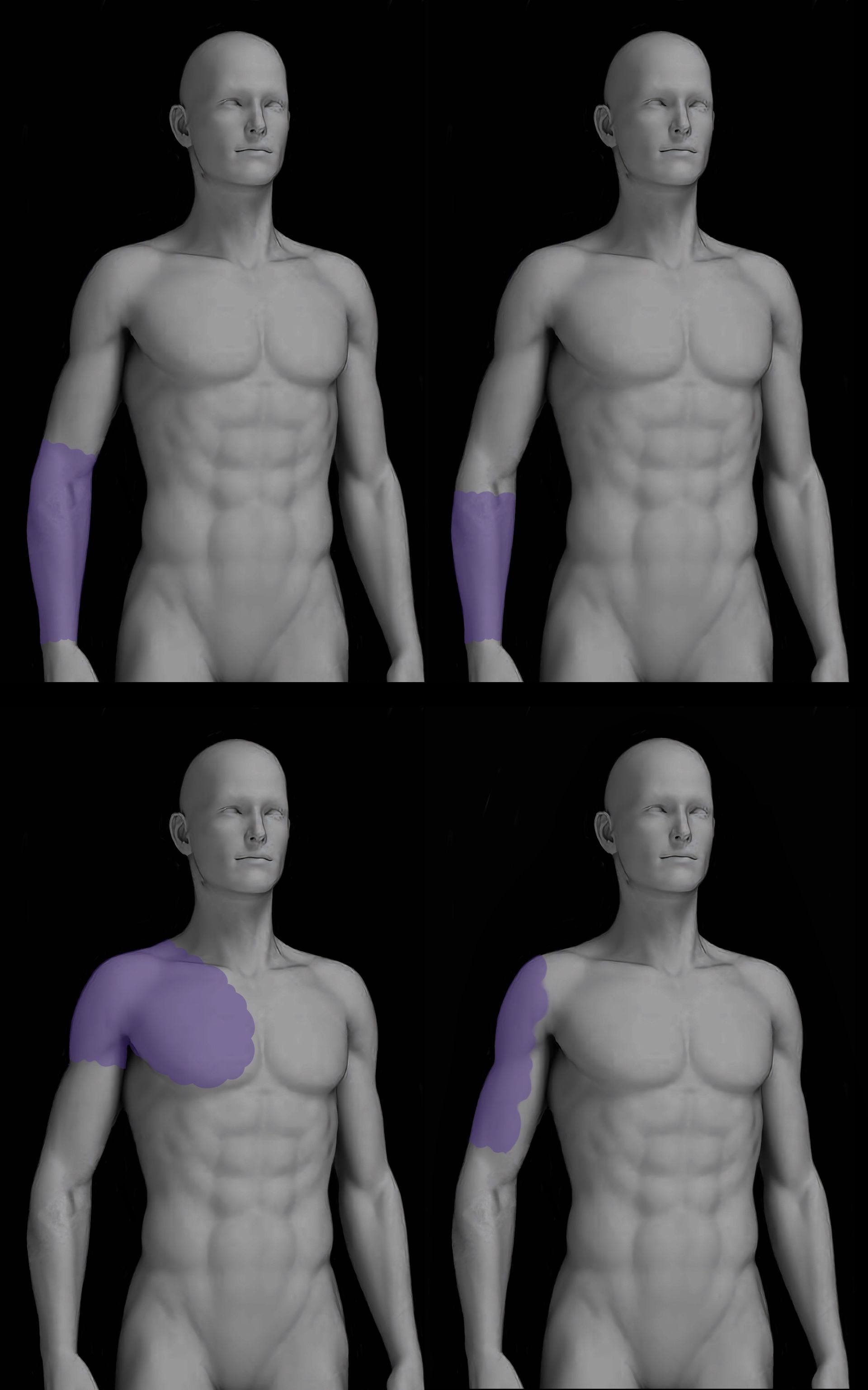 Four anatomical illustrations of a human torso, with purple highlighted areas of the arm and chest.