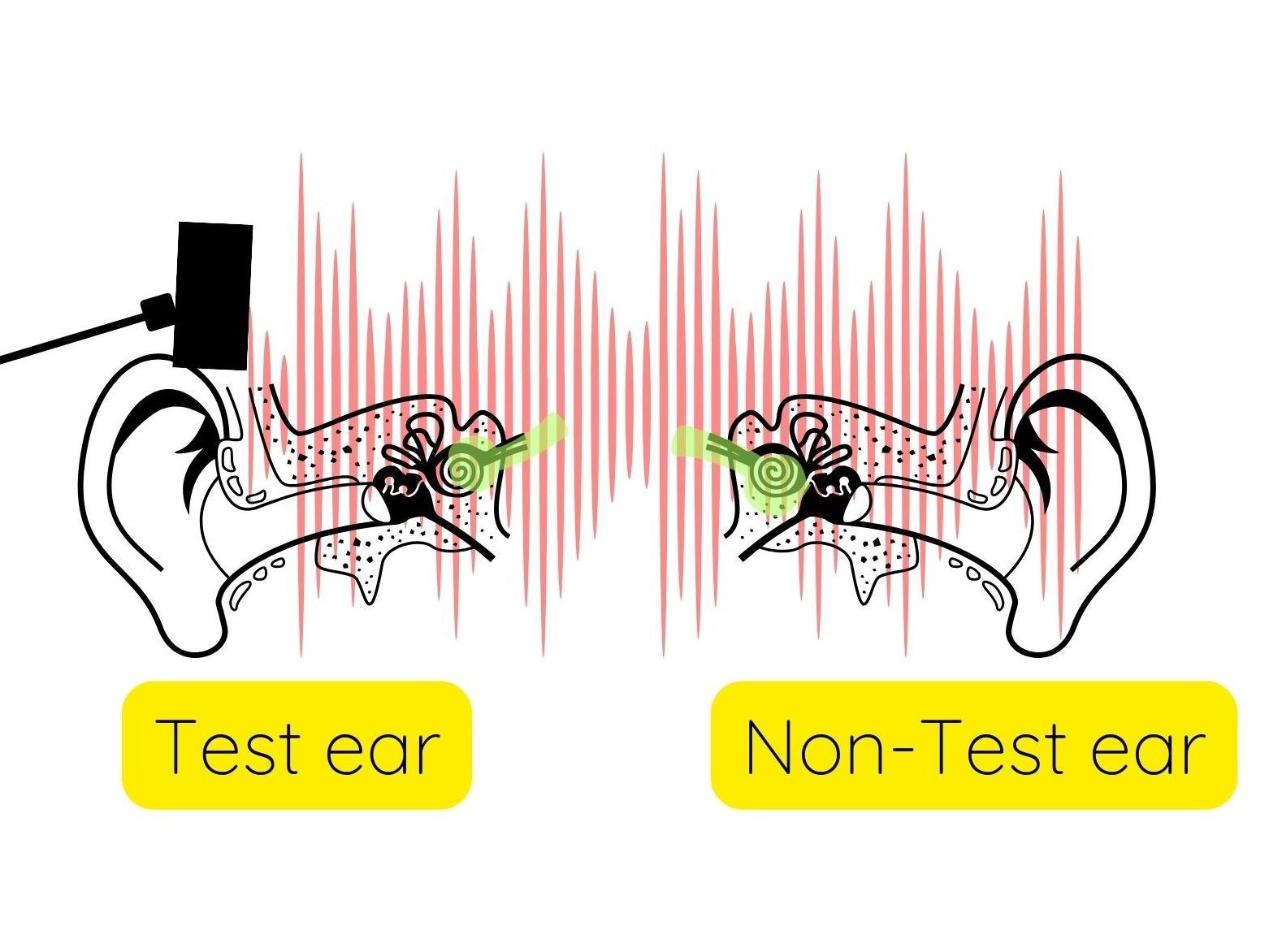 Masking in Audiology | Hearing Care