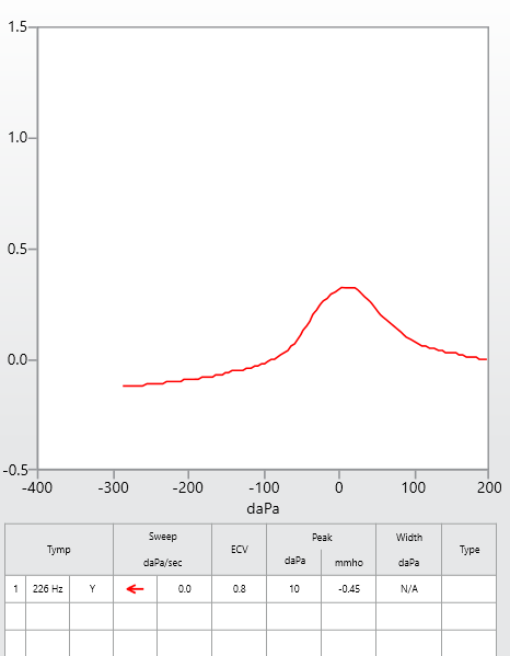 Red tympanogram graph showing a single peak.