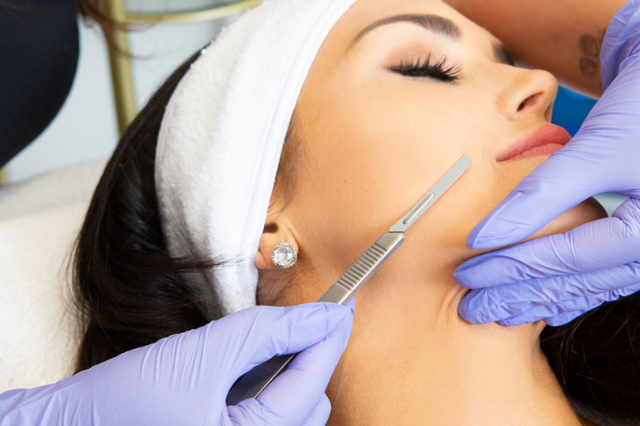 Book You Dermaplaning Procedure with YYC Laser & Skincare, Dermaplaning Facial, Dermaplaning Calgary
