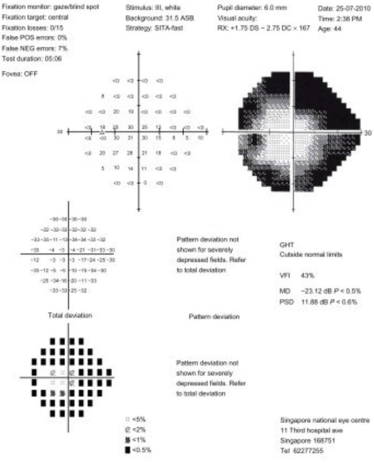 sensibilità al contrasto cromatico