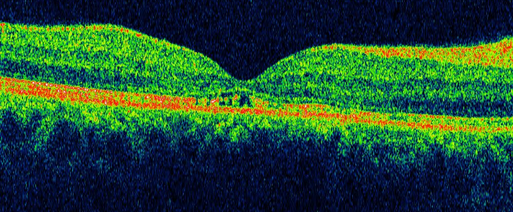 esame diagnostico oculare