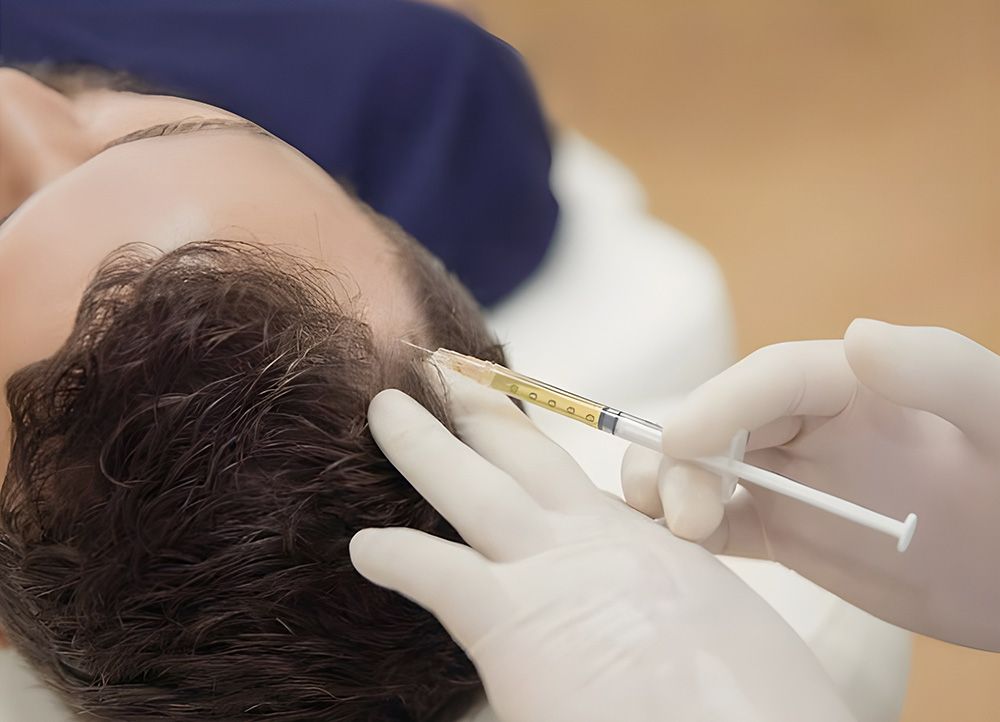 Person Receiving Scalp Injection with Gloved Hands — Nurose Aesthetics in Nundah, QLD