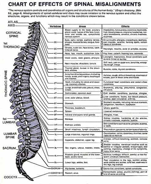 Chiropractic Misalignment chart West Charleston Chiropractic Las Vegas, NV