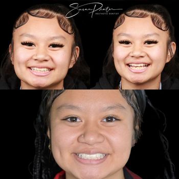 Three close-up smiling portraits on a black background, with two at the top and one below.