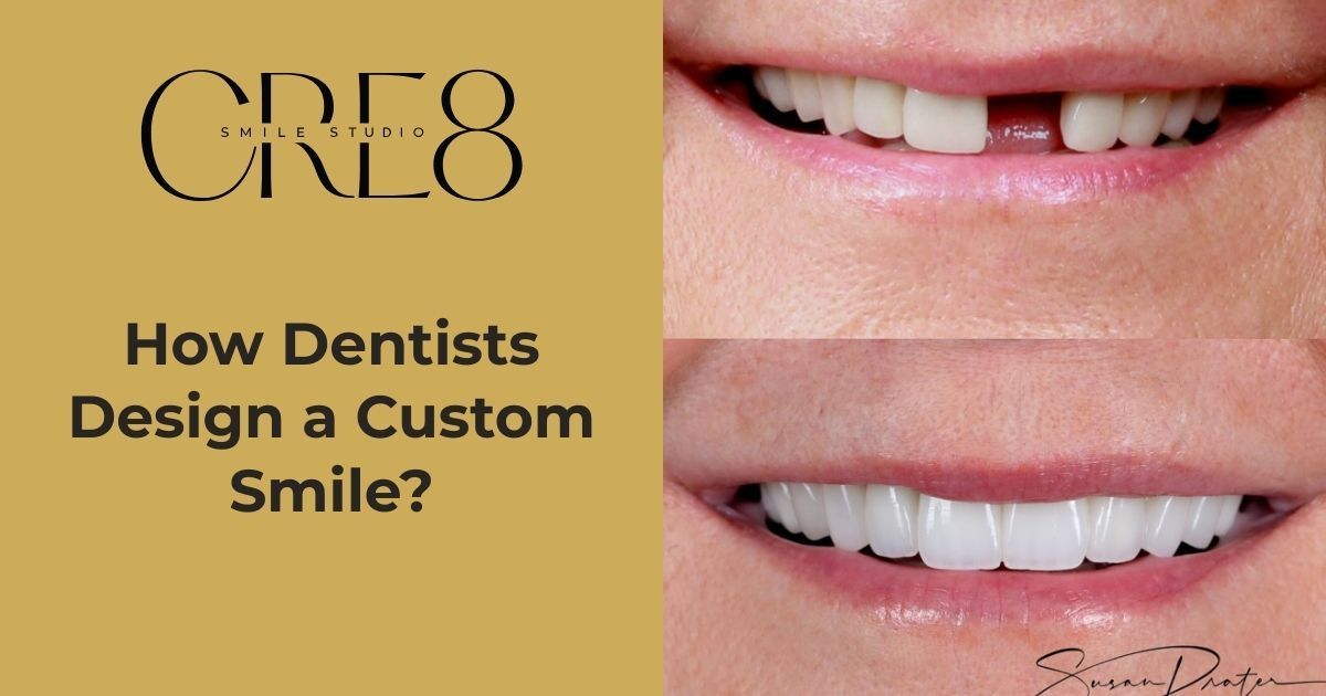 Before-and-after of a person's smile. The top shows a gap; the bottom, a full set of teeth.