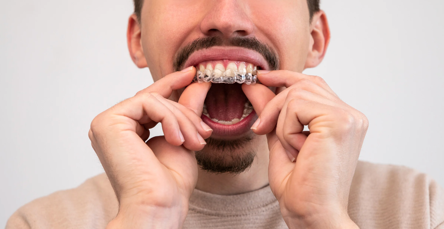 Is It Too Late for Me to Get Invisalign® As An Adult?