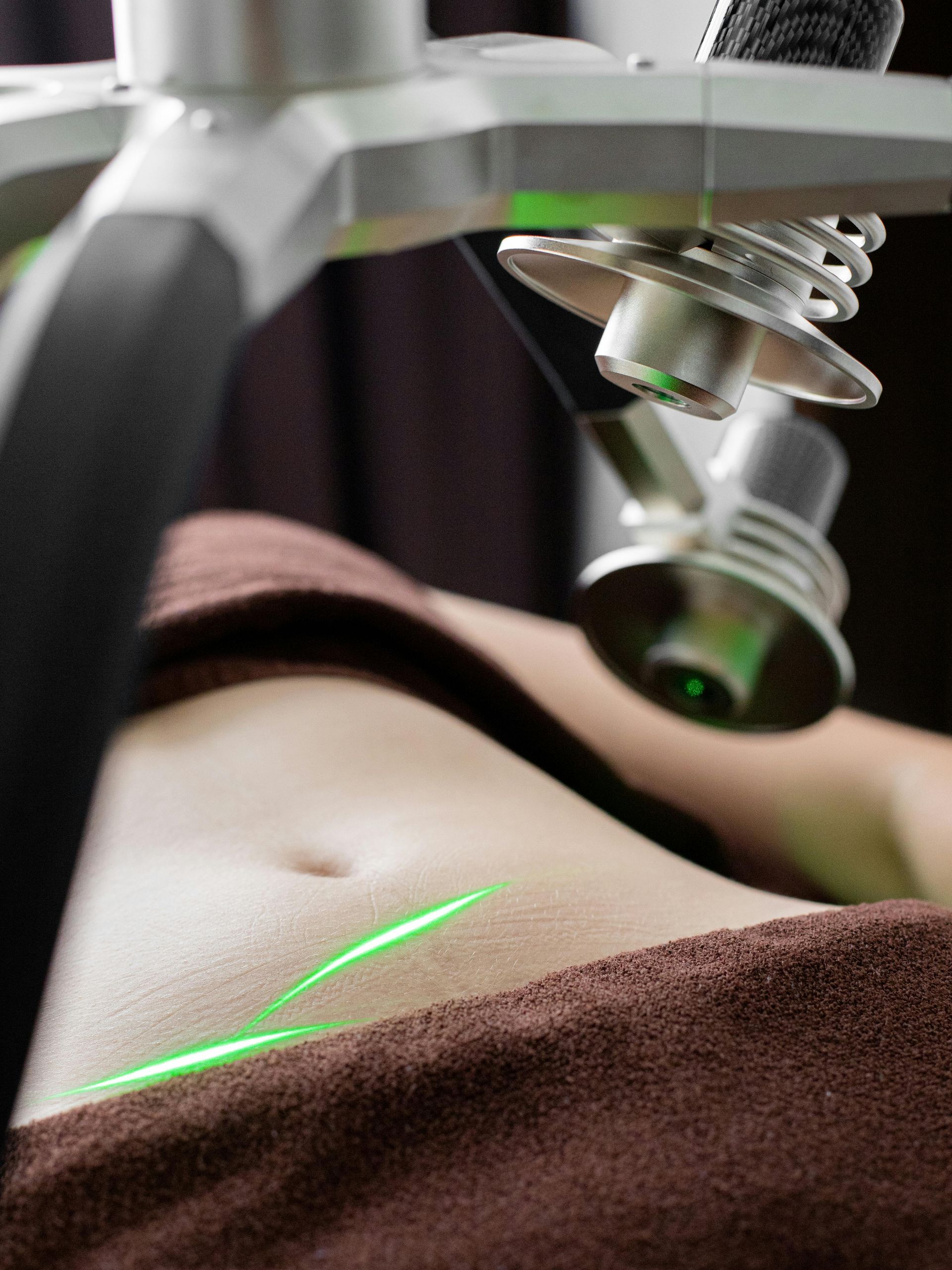 Laser treatment on a person's abdomen. A green laser line shines on the skin.