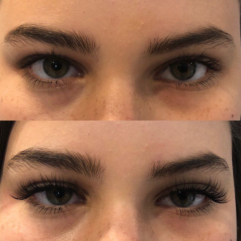 Health Spa Red bank, NJ Lotus Health & Aesthetics Spa