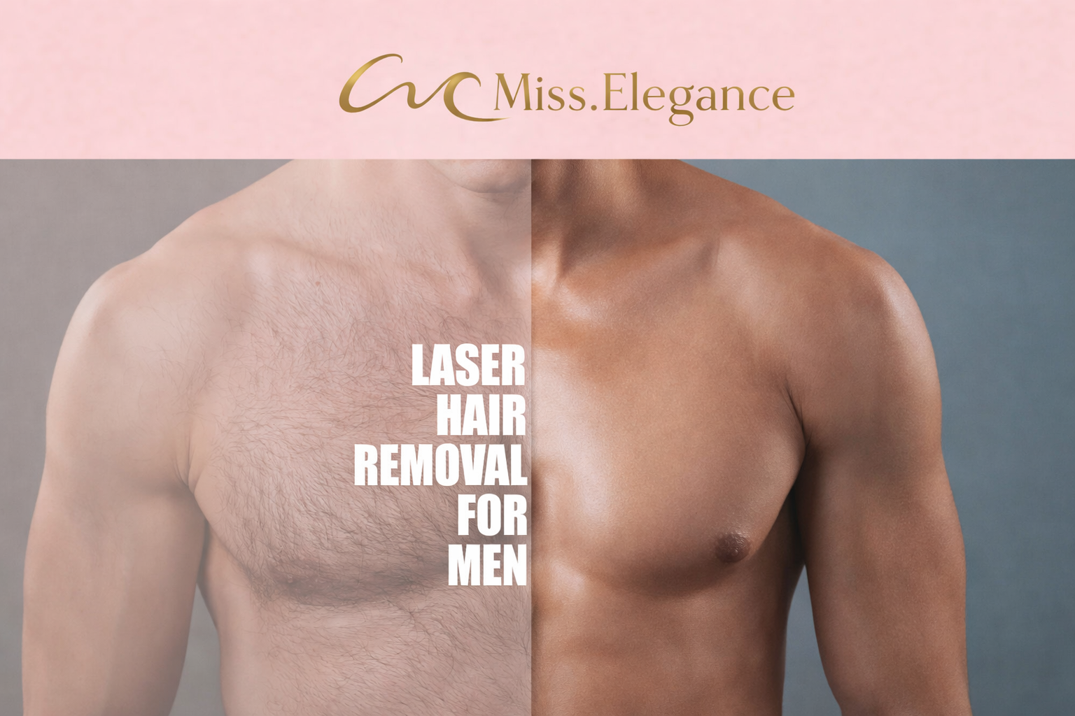 Laser ontharen voor mannen in Alkmaar Laser ontharen voor mannen in Alkmaar – comfortabel, krachtig en blijvend resultaat