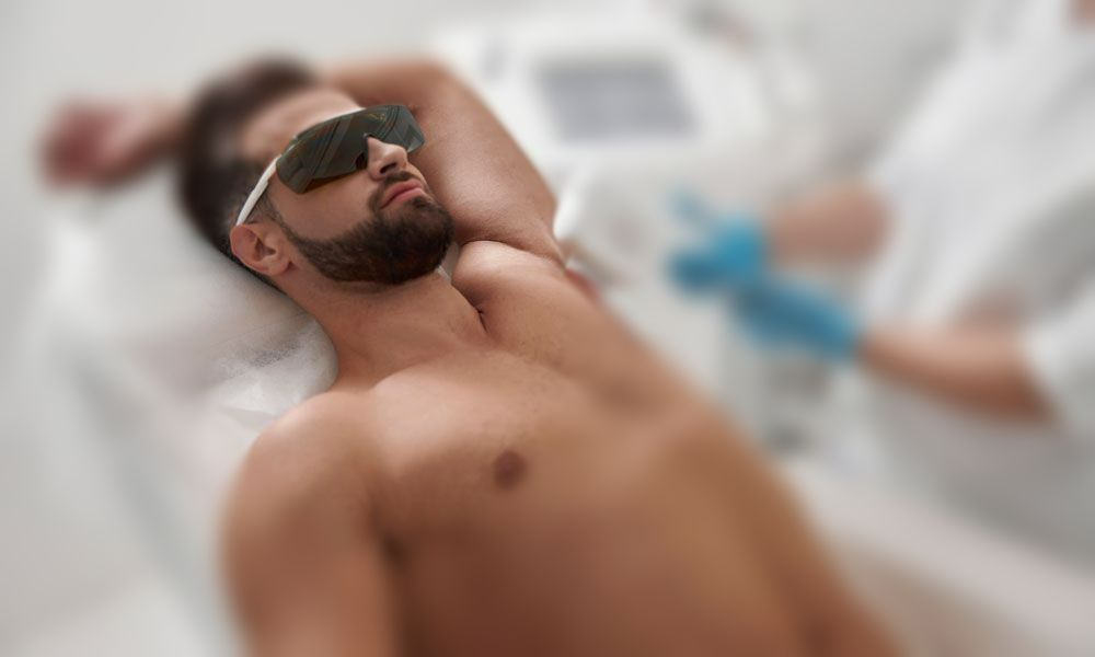 Laser ontharen voor mannen in Alkmaar – comfortabel, krachtig en blijvend resultaat