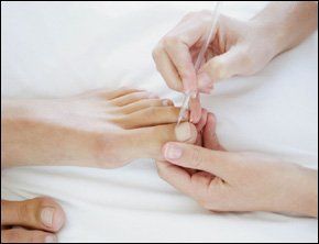 Foot problems - Nottingham, Nottinghamshire - The Nail Practitioner - Podiatry Podiatry
