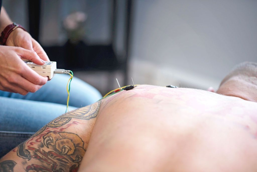 A man with tattoos is getting acupuncture on his back.