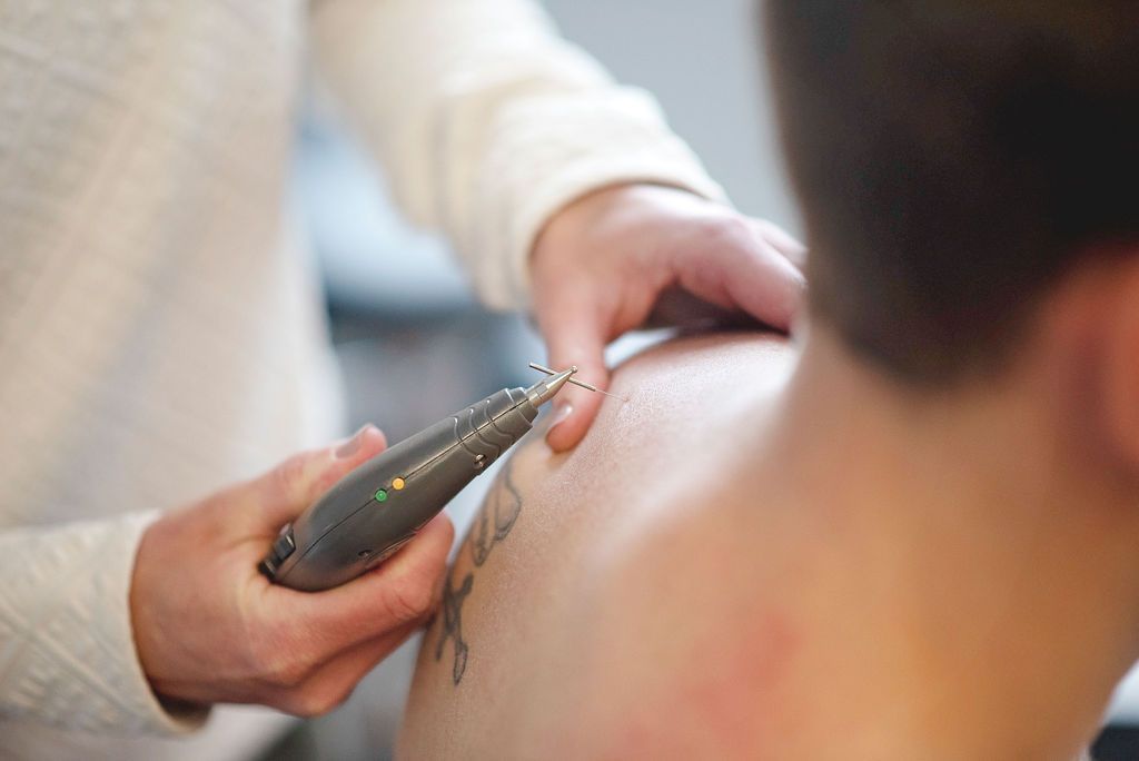 Person receiving tattoo removal on shoulder. A device held by hand.
