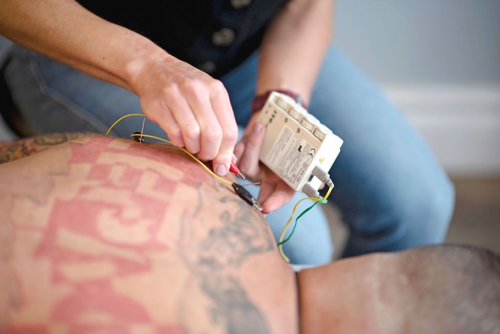 Person applying acupuncture needles to a tattooed back with a small device attached