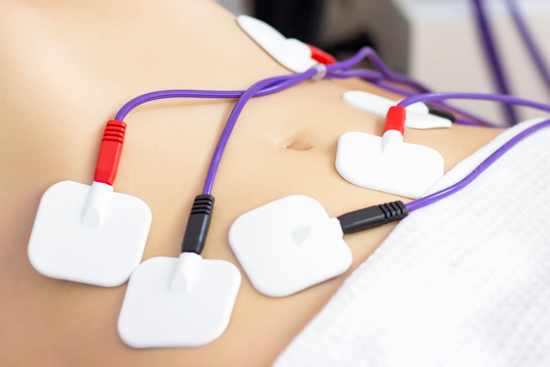 a woman is getting electrotherapy on her stomach