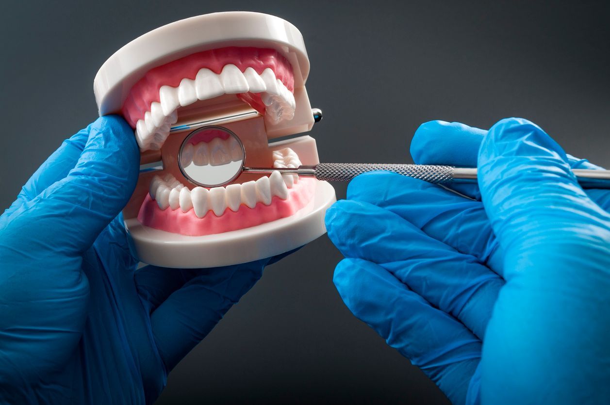 Hands holding a dental model while using tweezers to clean between the teeth