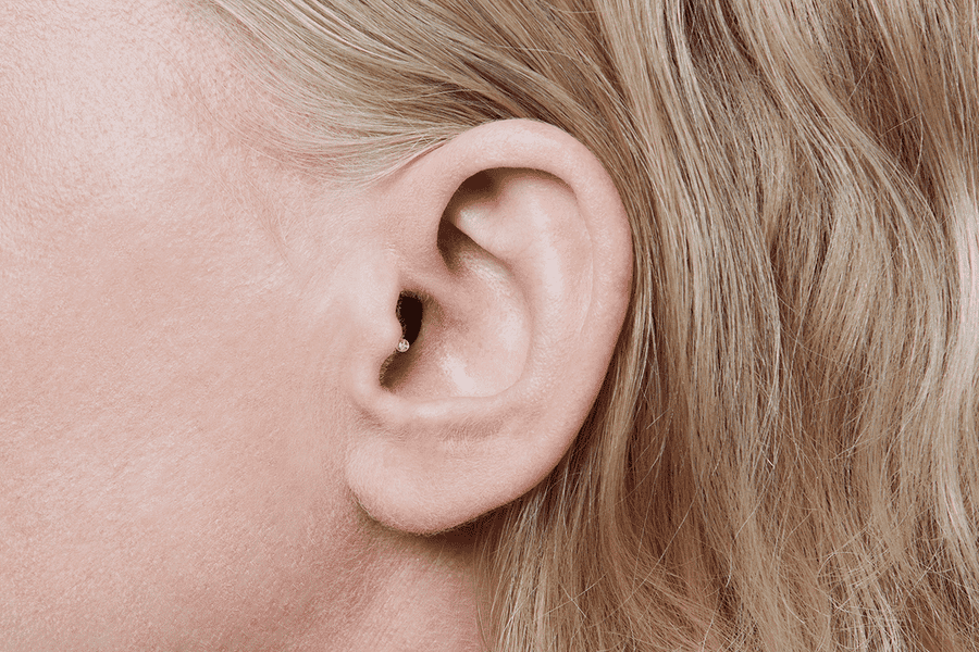 Un appareil auditif de type IIC - Invisible dans l'oreille