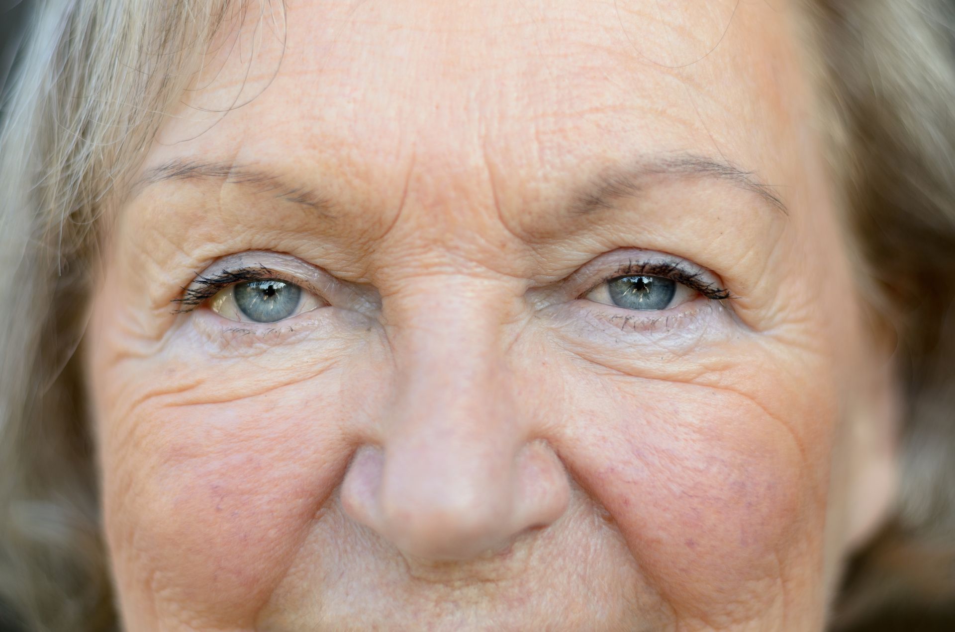 Rima-soboh-medecine-esthetique-Beauvais-traitement-rides