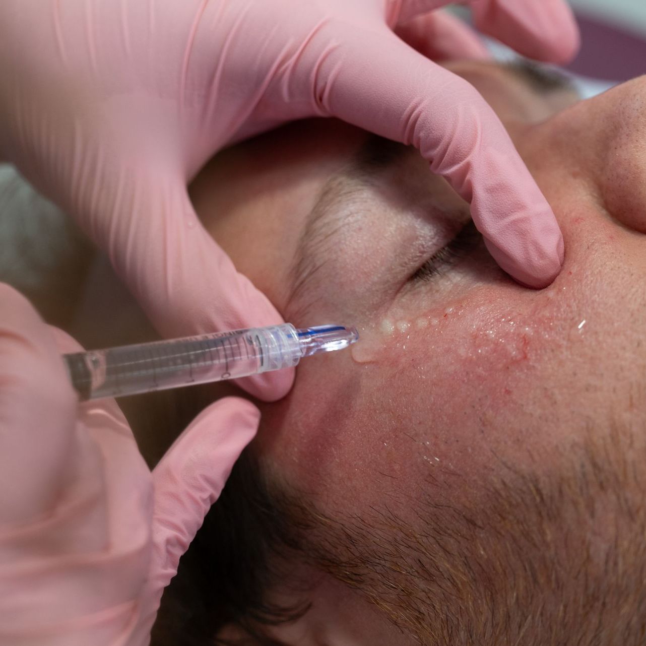 Rima-soboh-medecine-esthetique-Beauvais-6