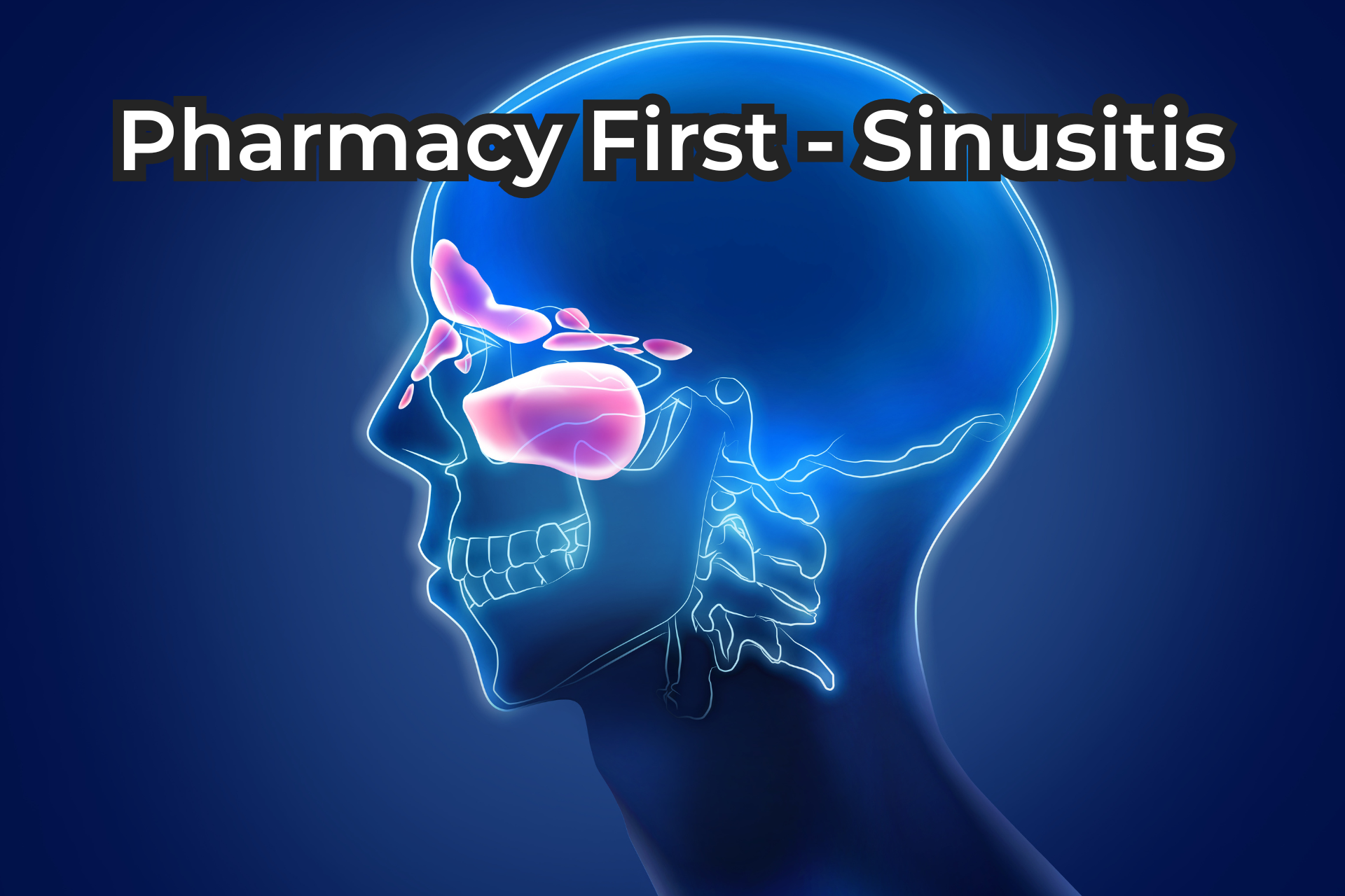 sinusitis-treatment-broadstairs-pharmacy-first