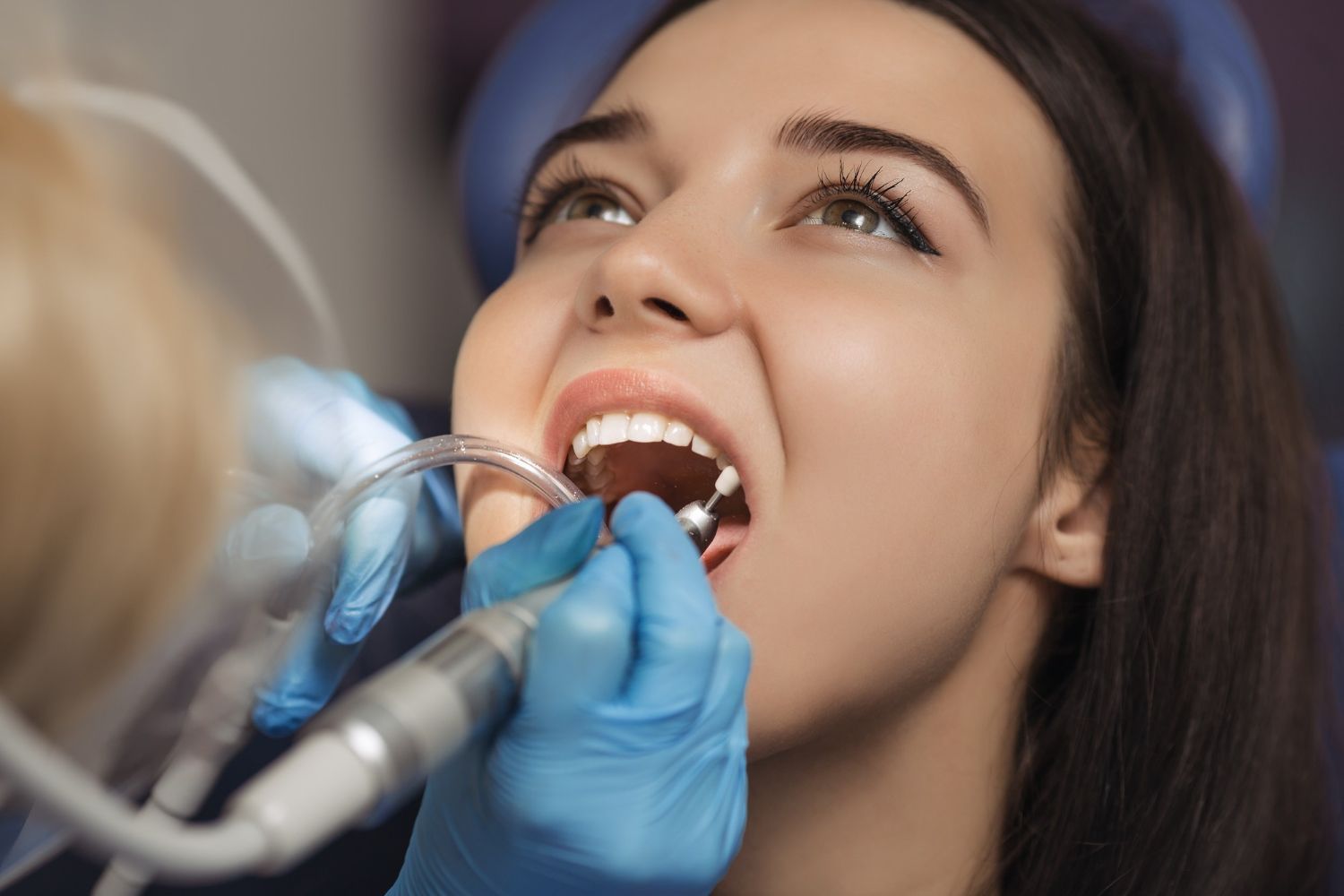 Dental Cleaning